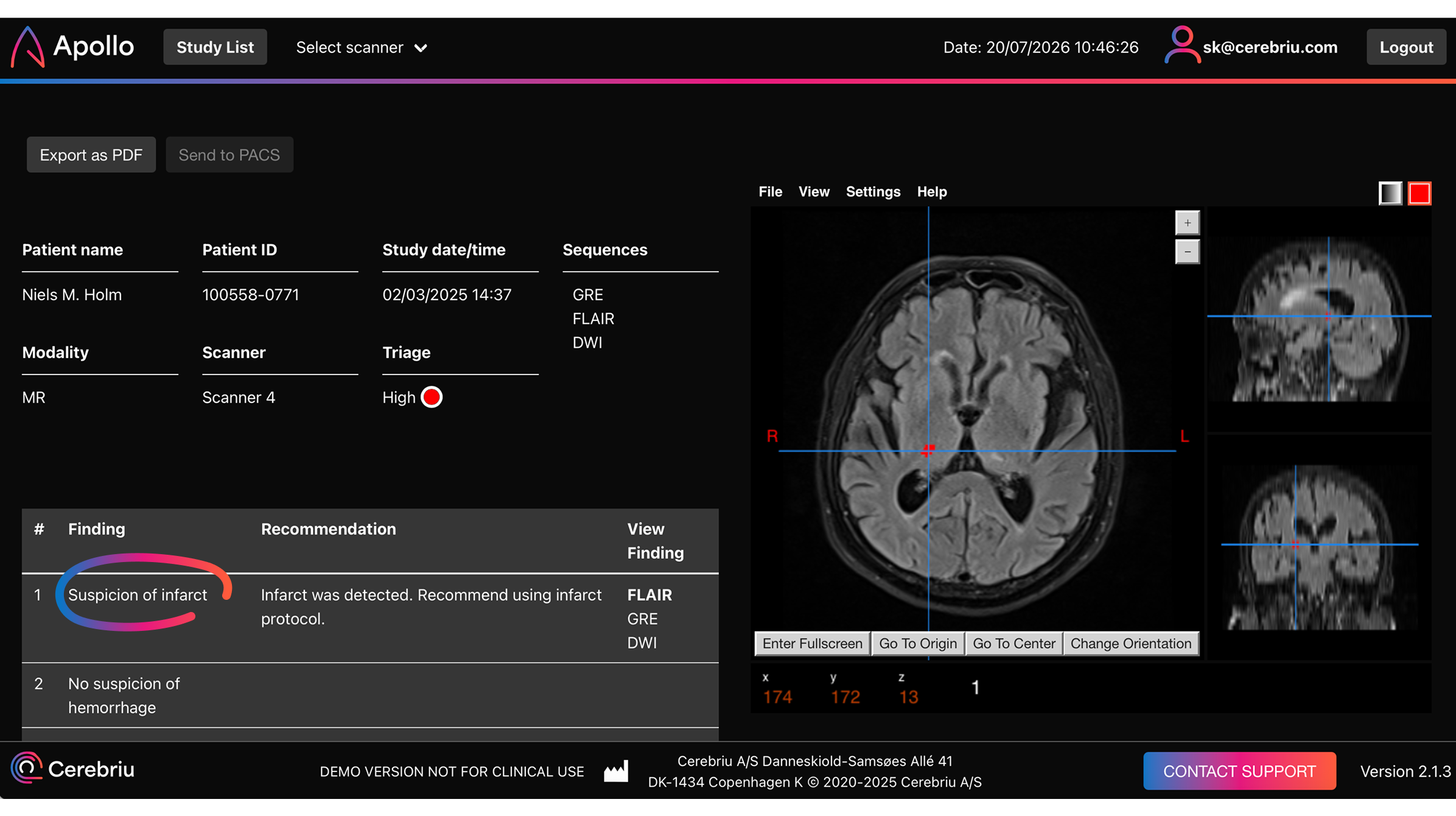 Apollo Acquire study view