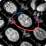 Cerebriu, the AI company transforming brain MRI workflows through real-time automation, today announced the appointment of Lars Green to its Board of Directors.